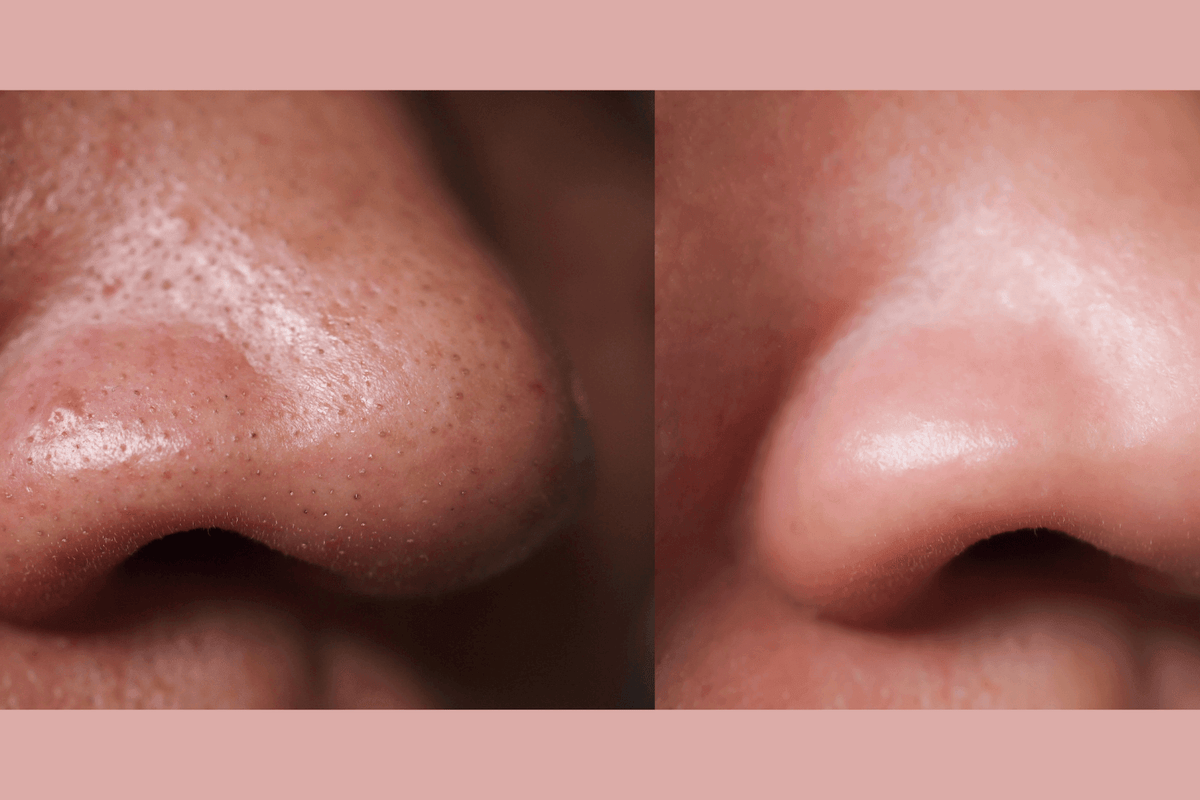 Ultra-Advanced Anti-Aging Daily Resurfacing Pads